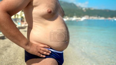 Téléchargez les photos : Jeune homme en surpoids libérant son gros ventre sur la plage de la mer. Concept de santé, minceur, régime, perte de poids avant l'été - en image libre de droit