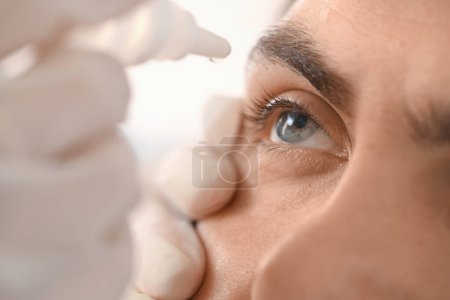 Foto de Oftalmólogo poniendo gotas en el ojo de un joven en el hospital, primer plano - Imagen libre de derechos