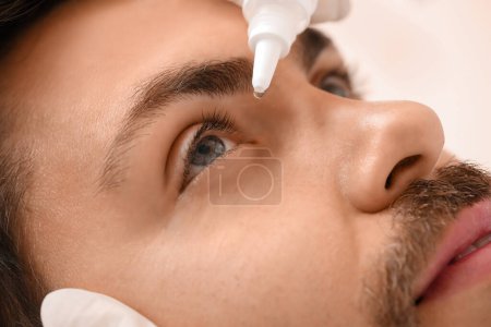 Foto de Oftalmólogo poniendo gotas en el ojo de un joven en el hospital, primer plano - Imagen libre de derechos