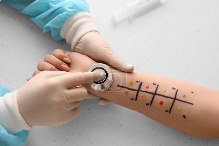 Téléchargez les photos : Médecin avec stéthoscope faisant un test cutané d'allergie sur la main du patient en clinique, gros plan - en image libre de droit