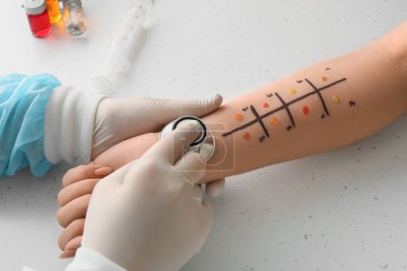 Téléchargez les photos : Médecin avec stéthoscope faisant un test cutané d'allergie sur la main du patient en clinique, gros plan - en image libre de droit