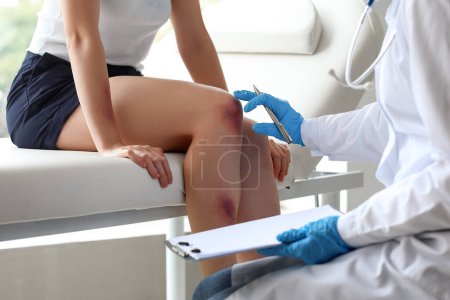 Photo for Female doctor examining patient's bruised knee in clinic - Royalty Free Image