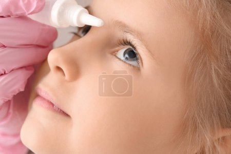 Foto de Ophthalmologist putting drops into little girl's eye in clinic, closeup - Imagen libre de derechos