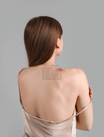 Foto de Mujer joven con mordedura de amor en el hombro contra fondo gris - Imagen libre de derechos