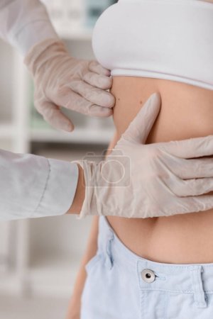 Foto de Dermatólogo examinando lunares en el vientre de la mujer joven en la clínica, primer plano - Imagen libre de derechos
