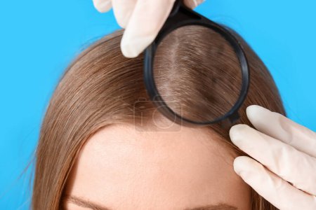 Foto de Tricólogo examinando el cuero cabelludo de la mujer joven, primer plano - Imagen libre de derechos