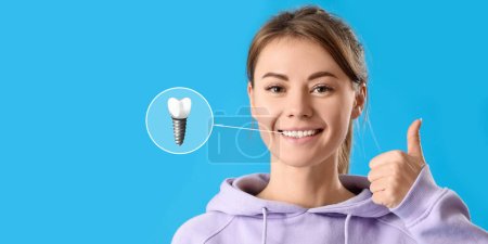 Téléchargez les photos : Jeune femme avec des dents implantées montrant geste pouce vers le haut sur fond bleu - en image libre de droit