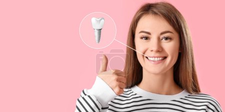 Photo for Young woman with implanted teeth showing thumb-up gesture on pink background - Royalty Free Image