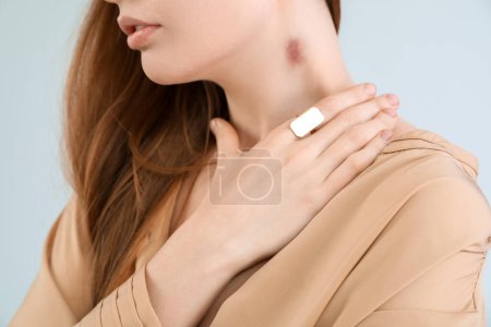 Foto de Mujer joven con mordedura de amor en el cuello contra fondo gris, primer plano - Imagen libre de derechos
