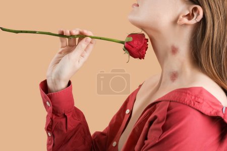 Young woman with love bites on her neck holding rose flower against color background, closeup