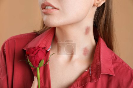 Woman with love bites on her neck and rose flower against color background, closeup