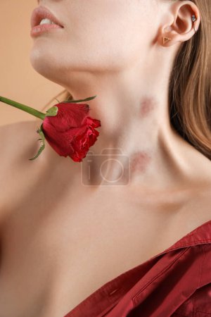 Foto de Mujer con mordeduras de amor en su cuello y rosa flor sobre fondo de color, primer plano - Imagen libre de derechos