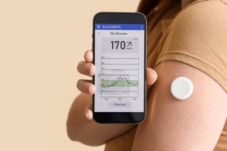 Téléchargez les photos : Femme avec capteur de glucose utilisant un téléphone portable pour mesurer le taux de sucre dans le sang sur fond beige, gros plan - en image libre de droit