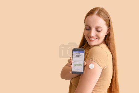 Téléchargez les photos : Femme avec capteur de glucose utilisant un téléphone portable pour mesurer le taux de sucre dans le sang sur fond beige - en image libre de droit