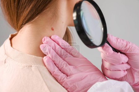 Dermatologist examining young woman's mole with magnifier on grey background, closeup