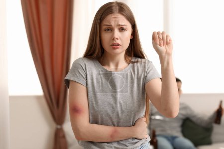 Téléchargez les photos : Jeune femme meurtrie montrant son poing à la maison. Concept de violence domestique - en image libre de droit