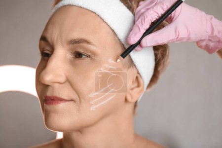 Photo for Beautician marking mature woman's face for filler injection in salon, closeup - Royalty Free Image