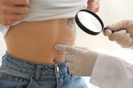 Dermatologist examining moles on young woman's belly with magnifier in clinic, closeup