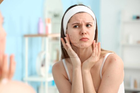 Photo for Upset teenage girl with acne problem looking in mirror at home, closeup - Royalty Free Image
