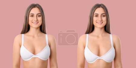 Téléchargez les photos : Femme avant et après correction de la taille des seins sur fond rose. Concept de chirurgie plastique - en image libre de droit
