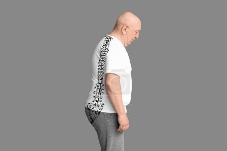 Photo for Senior man with poor posture on grey background - Royalty Free Image