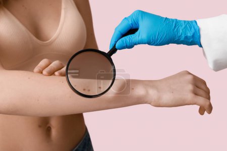 Téléchargez les photos : Dermatologue examinant les taupes de la jeune femme avec loupe sur fond rose, gros plan - en image libre de droit