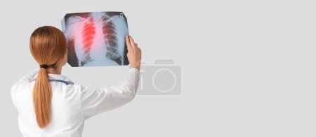 Photo for Female doctor holding x-ray image of lungs on light background with space for text - Royalty Free Image