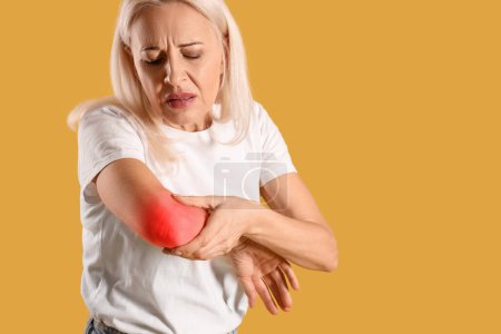 Photo for Mature woman feeling pain in elbow on yellow background - Royalty Free Image