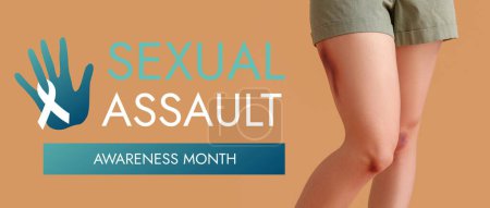 Young woman with bruised legs on beige background. Banner for Sexual Assault Awareness Month