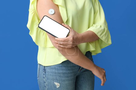 Frau mit Glukosesensor zur Messung des Blutzuckerspiegels und Telefon auf blauem Hintergrund. Diabetes-Konzept