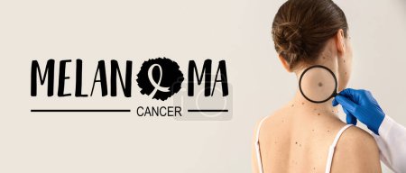 Photo for Dermatologist examining moles of patient on light background. Banner for Melanoma Cancer Awareness Month - Royalty Free Image