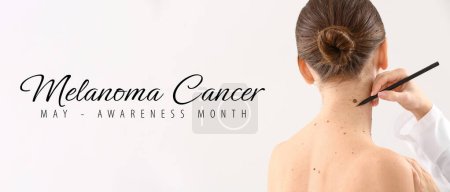 Photo for Dermatologist applying marks onto patient's skin before moles removal against light background. Banner for Melanoma Cancer Awareness Month - Royalty Free Image