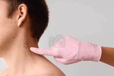 Photo for Dermatologist examining moles on young man's neck against light background, closeup - Royalty Free Image