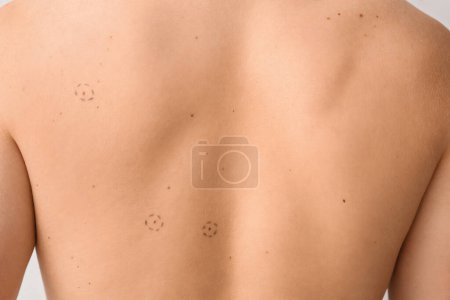 Photo for Young man with moles on light background, back view - Royalty Free Image