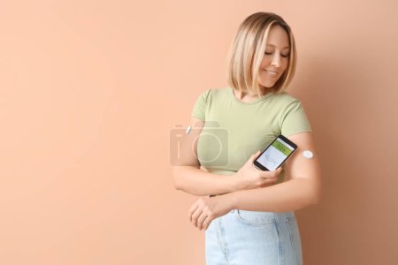 Diabetic woman with glucose sensor using mobile phone for measuring blood sugar level on beige background