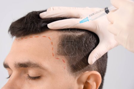 Photo for Young man with marked head receiving injection for hair growth on light background, closeup - Royalty Free Image
