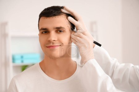 Photo for Doctor marking young man's head with hair loss problem in clinic, closeup - Royalty Free Image