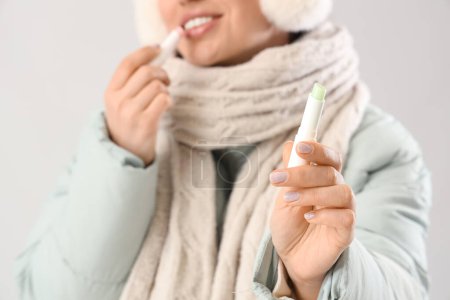 Young woman in winter clothes with lip balms on light background, closeup