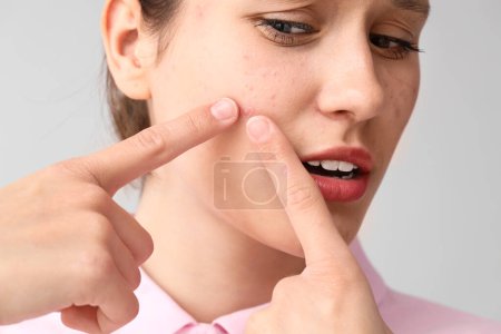 Beautiful young worried woman with acne problem squishing pimples on grey background