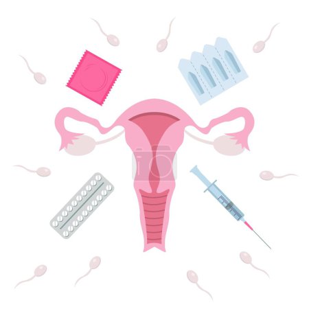 Ilustración de Human uterus with different contraceptive methods and sperm cells on white background - Imagen libre de derechos