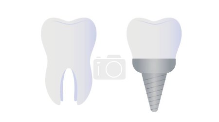 Natural and implanted teeth on white background