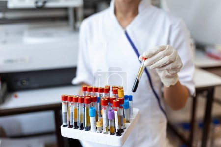 Téléchargez les photos : Main du médecin prise d'un tube d'échantillon de sang à partir d'un rack avec des machines d'analyse dans le fond du laboratoire / Technicien tenant un test de tube de sang dans le laboratoire de recherche - en image libre de droit