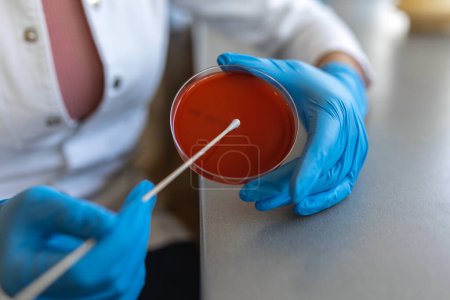 Photo for Clean culture of bacteria on agar plate. Selective focus on petri dish, slightly blue toned, A scientist holds a petri dish. The hand is covered with a latex glove. - Royalty Free Image