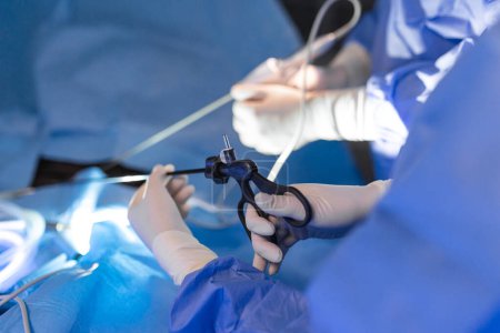 El cirujano está perforando el instrumento en el abdomen del paciente. El cirujano está haciendo cirugía laparoscópica en el quirófano. Cirugía mínimamente invasiva.