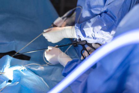 Téléchargez les photos : Le chirurgien enfonce l'instrument dans l'abdomen du patient. Le chirurgien fait une opération laparoscopique dans la salle d'opération. Chirurgie mini-invasive. - en image libre de droit
