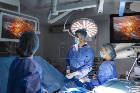 Foto de Proceso de cirugía ginecológica utilizando equipo laparoscópico. Grupo de cirujanos en quirófano con equipo quirúrgico. Contexto - Imagen libre de derechos