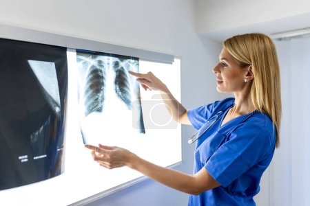 Téléchargez les photos : Radiologie et médecine concept. médecin expliquant les résultats du scanner pulmonaire à l'écran au patient âgé. - en image libre de droit