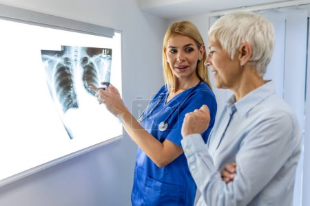 Téléchargez les photos : Médecin femme vérifiant le film radiographique dans un laboratoire médical à l'hôpital, expliquant les résultats du scanner pulmonaire à l'écran au patient âgé. - en image libre de droit