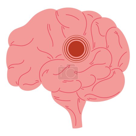 Welt-Parkinson-Tag Gehirnerkrankung Illustration Vektor