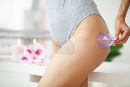 Photo for Woman getting anti-cellulite massage of leg with use of vacuum cans. - Royalty Free Image